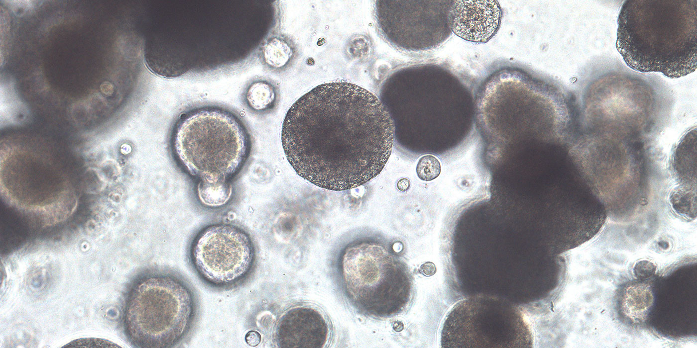 CUHK launches Asia’s first organoid biobank for bladder cancer